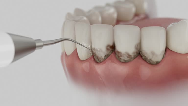 Trusted Dental Crowns And Bridges service in Morgantown, KY - Dentist Open Now